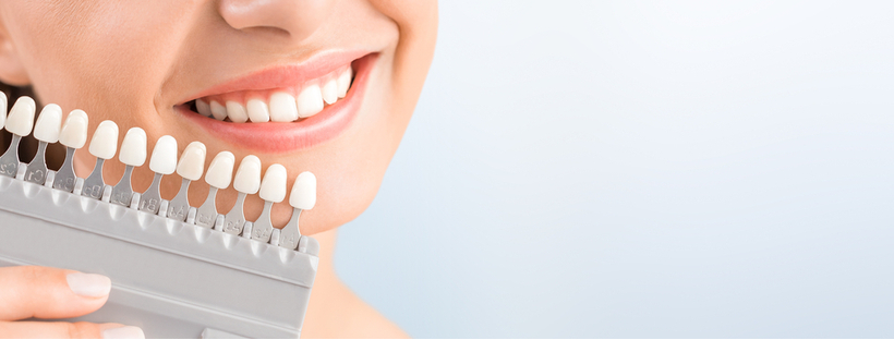Best 10 Teeth Whitening Companies